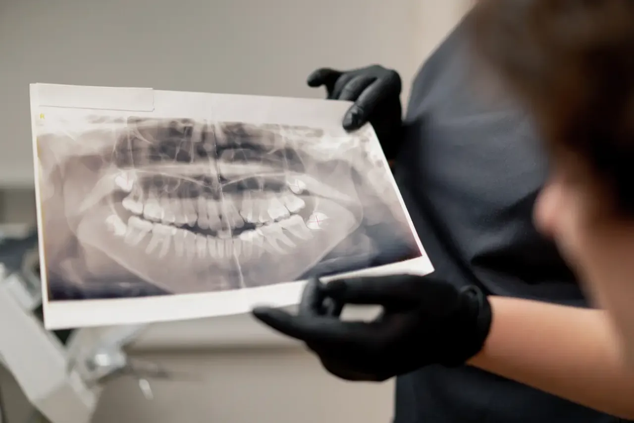 Pantomogram: Co dentysta widzi na zdjęciu? Ukryte problemy jamy ustnej