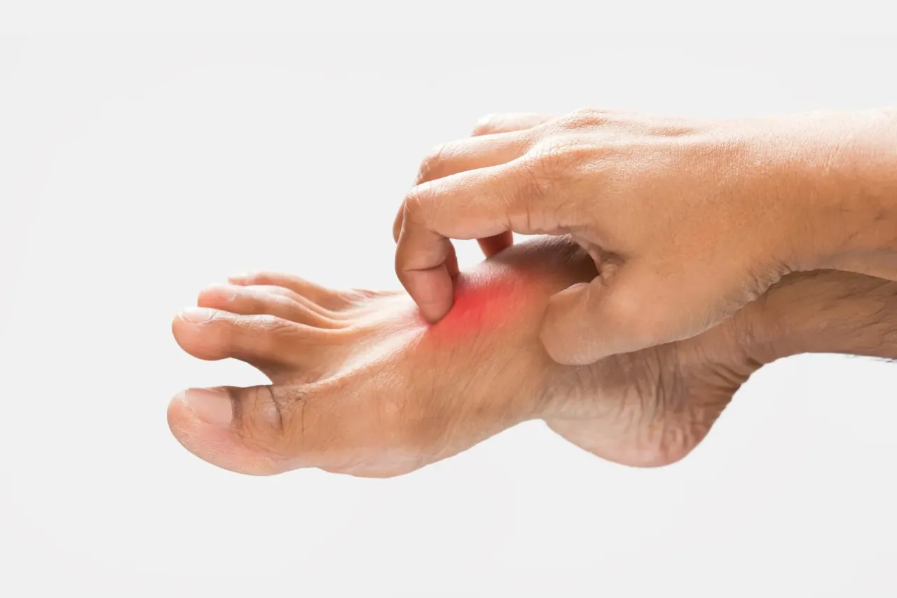 Dolor en el empeine - ¿Cuándo preocuparse y qué hacer?
