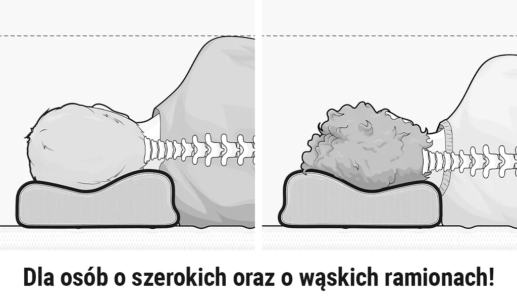 Skręcenie karku objawy: Jak rozpoznać i uniknąć bólu szyi