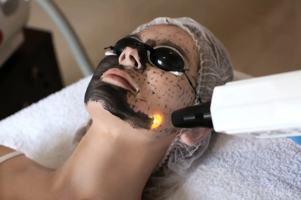Peeling węglowy - jak szybko odświeżyć cerę? Efekty, cena i pory Peeling węglowy - jak szybko odświeżyć cerę? Efekty, cena i pory