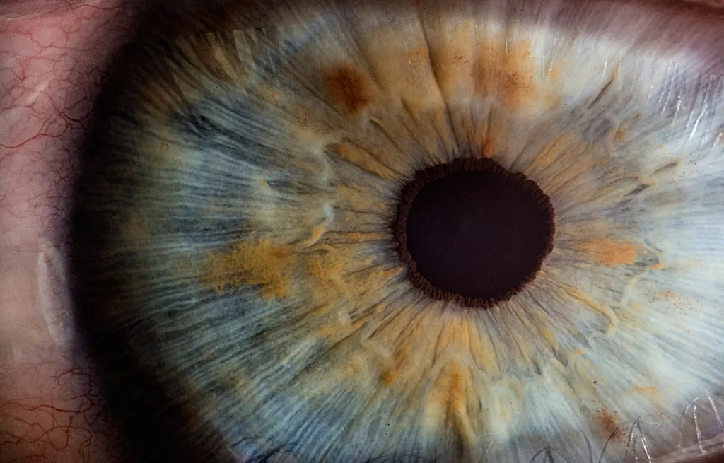 Ślepota zmierzchowa: przyczyny, objawy i skuteczne metody diagnozy Ślepota zmierzchowa: przyczyny, objawy i skuteczne metody diagnozy