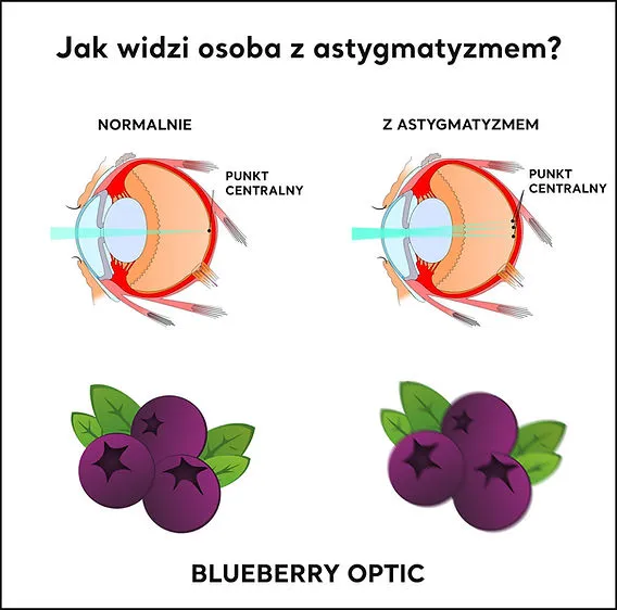 Astygmatyzm: Plusy, minusy i cylinder? Zrozum swoją wadę!