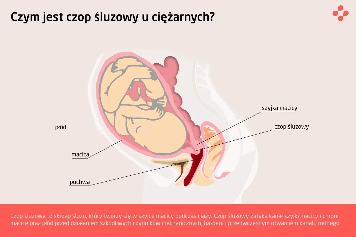 Czop śluzowy - sygnał porodu czy powód do niepokoju?